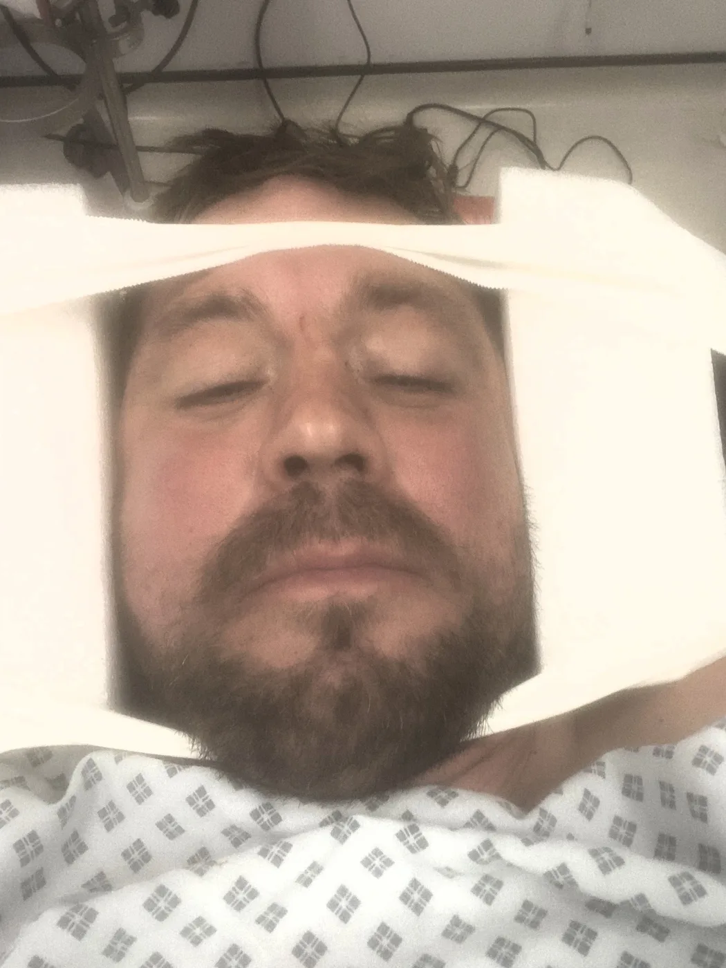 Peter Evans lying on a hospital bed in a patient gown, with white padding across his forehead and around his face